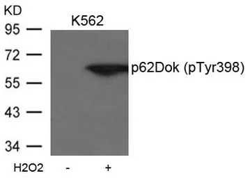 Anti-p62Dok (phospho Tyr398) antibody used in Western Blot (WB). GTX50298