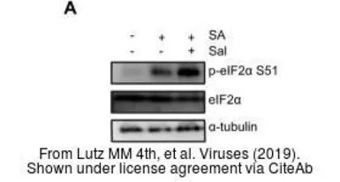 Anti-eIF2 alpha (phospho Ser51) antibody used in Western Blot (WB). GTX50300