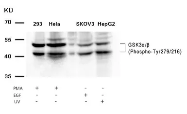 Anti-GSK3 alpha (phospho Tyr279) + GSK3 beta (phospho Tyr216) antibody used in Western Blot (WB). GTX50316