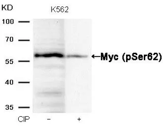 Anti-c-Myc (phospho Ser62) antibody used in Western Blot (WB). GTX50323