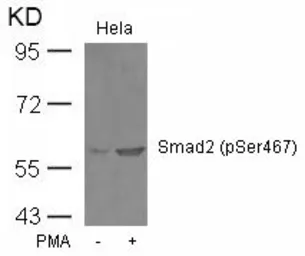 Anti-SMAD2 (phospho Ser467) antibody used in Western Blot (WB). GTX50331