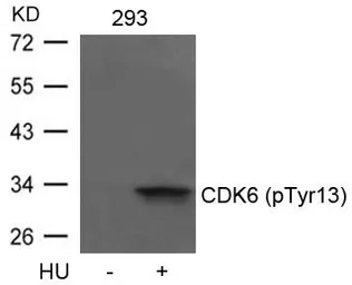 Anti-CDK6 (Phospho Tyr13) antibody used in Western Blot (WB). GTX50352