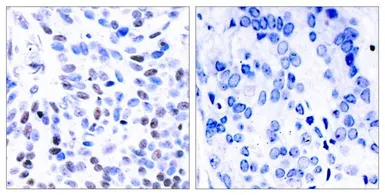 Anti-NFkB p100 antibody used in IHC (Paraffin sections) (IHC-P). GTX50375