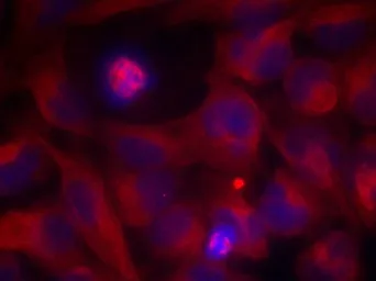 Anti-c-Rel antibody used in Immunocytochemistry/ Immunofluorescence (ICC/IF). GTX50380