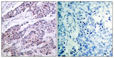 Anti-Bcl-2 antibody used in IHC (Paraffin sections) (IHC-P). GTX50413