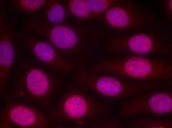 Anti-Estrogen Receptor alpha antibody used in Immunocytochemistry/ Immunofluorescence (ICC/IF). GTX50420
