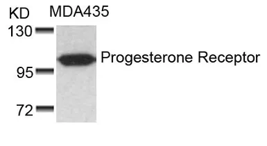Anti-Progesterone Receptor antibody used in Western Blot (WB). GTX50422