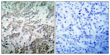 Anti-p53 antibody used in IHC (Paraffin sections) (IHC-P). GTX50438