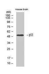 Anti-p53 antibody used in Western Blot (WB). GTX50438