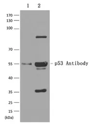 Anti-p53 antibody used in Western Blot (WB). GTX50438