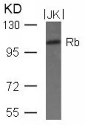 Anti-Rb antibody used in Western Blot (WB). GTX50460