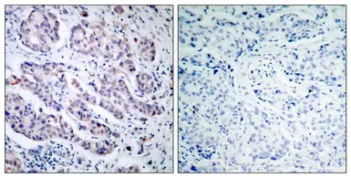 Anti-TYK2 antibody used in IHC (Paraffin sections) (IHC-P). GTX50465
