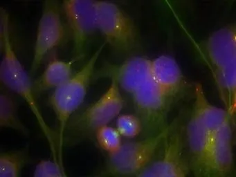 Anti-FAK antibody used in Immunocytochemistry/ Immunofluorescence (ICC/IF). GTX50489