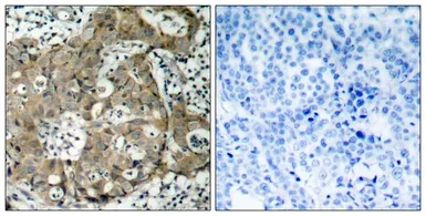 Anti-FOXO1 antibody used in IHC (Paraffin sections) (IHC-P). GTX50499