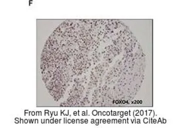 Anti-FOXO4 antibody used in IHC (Paraffin sections) (IHC-P). GTX50500