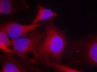 Anti-PLCG2 antibody used in Immunocytochemistry/ Immunofluorescence (ICC/IF). GTX50517