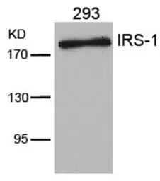 Anti-IRS1 antibody used in Western Blot (WB). GTX50550