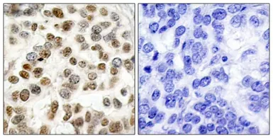 Anti-BRCA1 antibody used in IHC (Paraffin sections) (IHC-P). GTX50557