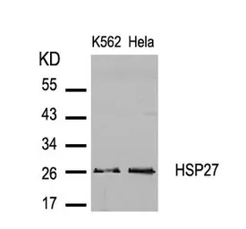 Anti-HSP27 antibody used in Western Blot (WB). GTX50563
