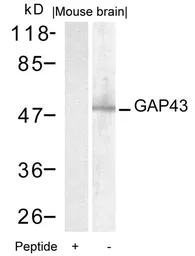 Anti-GAP43 antibody used in Western Blot (WB). GTX50592