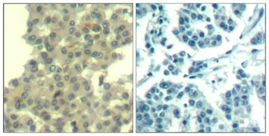 Anti-Her3 / ErbB3 antibody used in IHC (Paraffin sections) (IHC-P). GTX50651