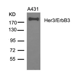Anti-Her3 / ErbB3 antibody used in Western Blot (WB). GTX50651