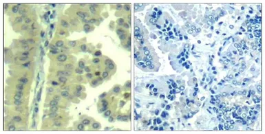 Anti-eIF4G antibody used in IHC (Paraffin sections) (IHC-P). GTX50653