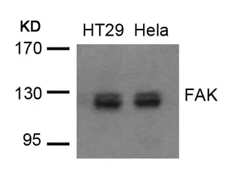 Anti-FAK antibody used in Western Blot (WB). GTX50666