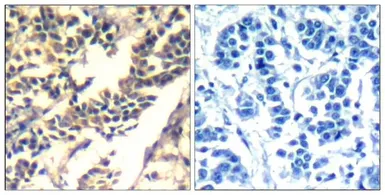 Anti-CBL antibody used in IHC (Paraffin sections) (IHC-P). GTX50669