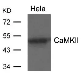 Anti-CaMKII alpha antibody used in Western Blot (WB). GTX50706
