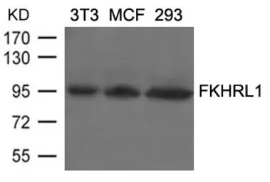 Anti-FOXO3A antibody used in Western Blot (WB). GTX50856