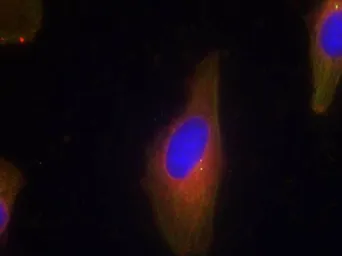 Anti-Synaptotagmin 1/2 antibody used in Immunocytochemistry/ Immunofluorescence (ICC/IF). GTX50862