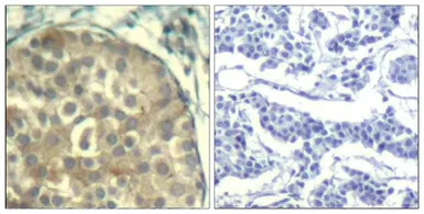 Anti-Cofilin (phospho Tyr89) antibody used in IHC (Paraffin sections) (IHC-P). GTX50866