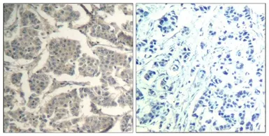 Anti-Cofilin1/Cofilin2 antibody used in IHC (Paraffin sections) (IHC-P). GTX50872