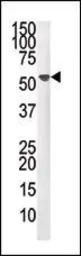 Anti-PPM1F antibody, N-term used in Western Blot (WB). GTX50878