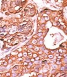 Anti-PPM1F antibody, N-term used in IHC (Paraffin sections) (IHC-P). GTX50878