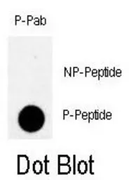 Anti-Rad9 (phospho Ser328) antibody used in Dot blot (Dot). GTX50885