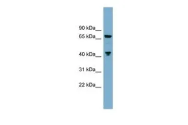 Anti-Glutaminase (KGA) antibody, C-term used in Western Blot (WB). GTX50891
