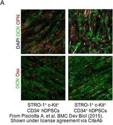 Anti-SP7 antibody, C-term used in Immunocytochemistry/ Immunofluorescence (ICC/IF). GTX50962