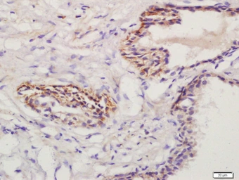 Anti-Prostaglandin E Receptor EP1 antibody used in IHC (Paraffin sections) (IHC-P). GTX50972