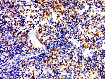 Anti-CD4 antibody used in IHC (Paraffin sections) (IHC-P). GTX50984