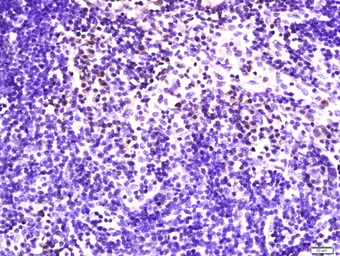 Anti-NKG2D antibody used in IHC (Paraffin sections) (IHC-P). GTX50988