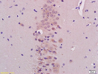Anti-BHLHB9 antibody used in IHC (Paraffin sections) (IHC-P). GTX51145