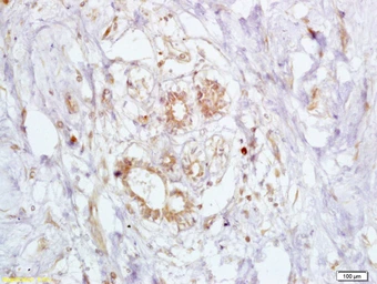 Anti-BRCA2 antibody used in IHC (Paraffin sections) (IHC-P). GTX51235