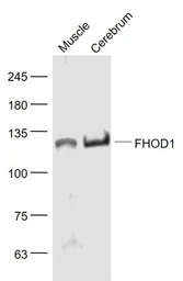 Anti-FHOD1 antibody used in Western Blot (WB). GTX51345