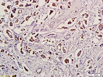Anti-Ubiquitin antibody used in IHC (Paraffin sections) (IHC-P). GTX51517