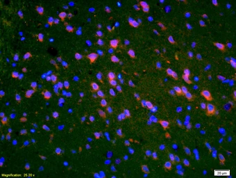 Anti-PMP2 antibody used in IHC (Paraffin sections) (IHC-P). GTX51529