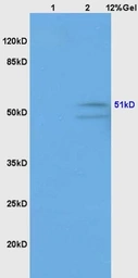 Anti-GABA A Receptor gamma 2 antibody used in Western Blot (WB). GTX51587
