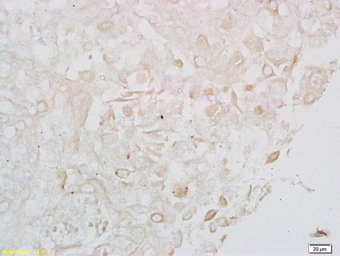 Anti-LONP1 antibody used in IHC (Paraffin sections) (IHC-P). GTX51596