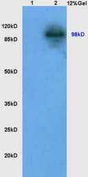 Anti-LONP1 antibody used in Western Blot (WB). GTX51596
